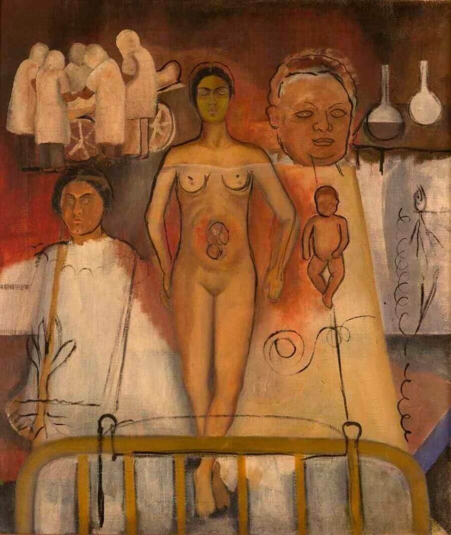 Frida and Cesarean Operation, 1932 by Frida Kahlo